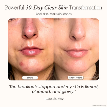 Reveal Your Radiance and Boost Your Confidence