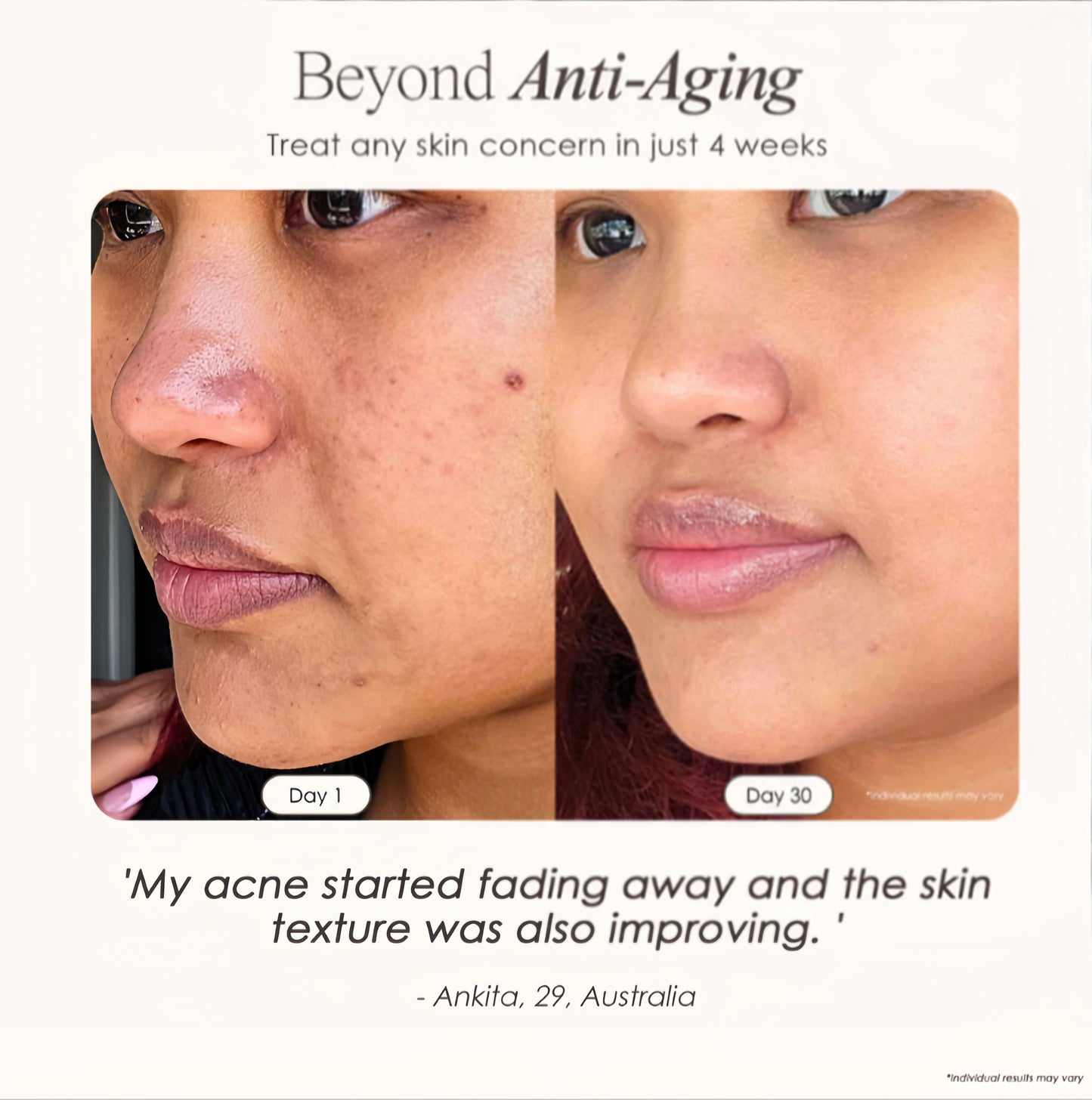 Arika™ Derma High Frequency Therapy Kit