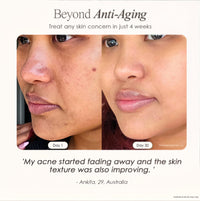 Arika™ Derma High Frequency Therapy Kit