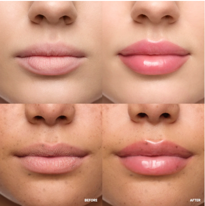 Arika Queen Overnight Collagen Lip Plumping Tape™