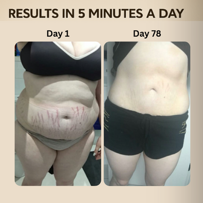 Body Tightening & Cellulite Reduction Red Light Therapy Kit™